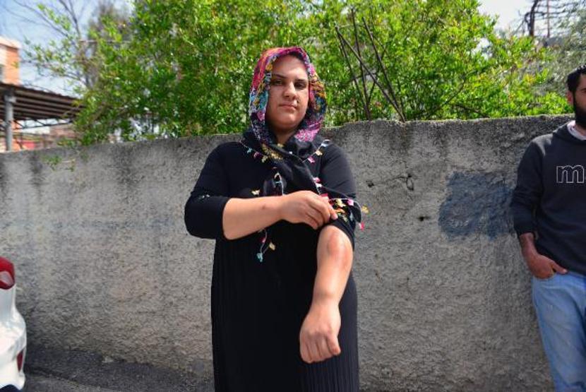 Gaspçının aracıyla metrelerce sürüklendi: Bu bir canilik