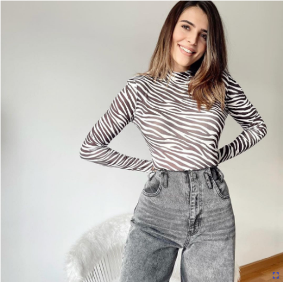 Survivor Merve Aydın estetikle bambaşka biri oldu