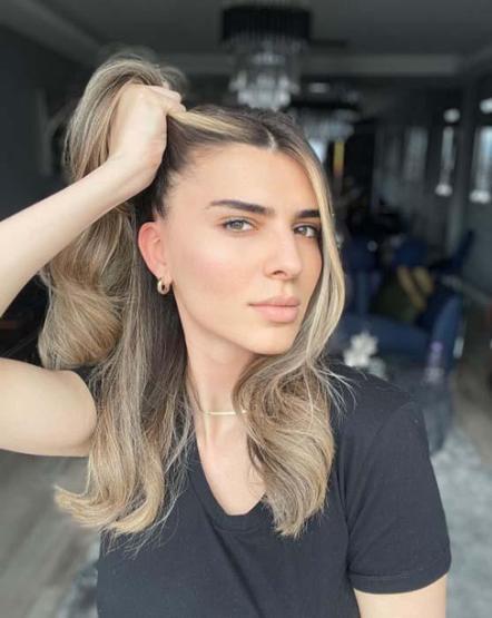 Survivor Merve Aydın estetikle bambaşka biri oldu