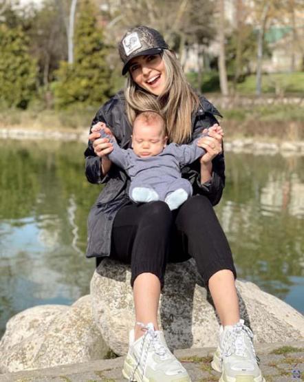 Survivor Merve Aydın estetikle bambaşka biri oldu