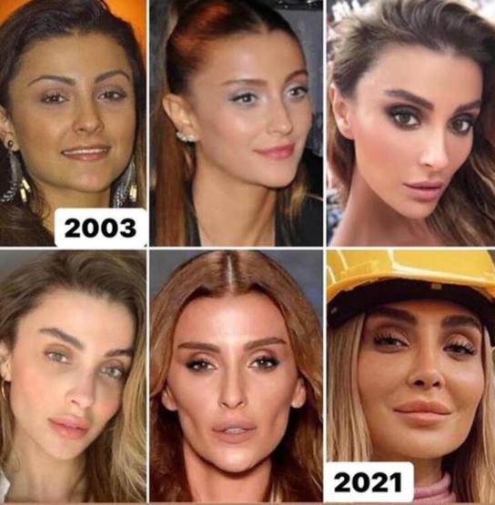 Özge Ulusoy kafasına çöp poşeti geçirmesi hakkında konuştu