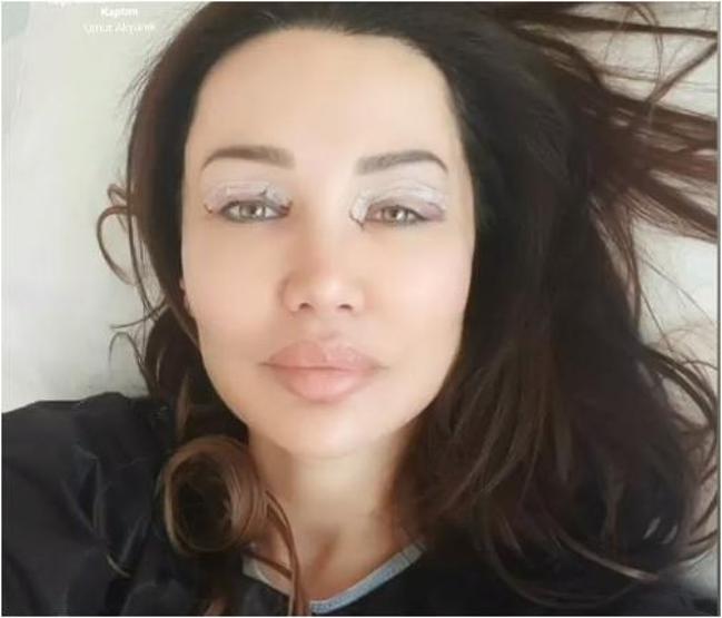Umut Akyürek göz kapağı ameliyatı oldu