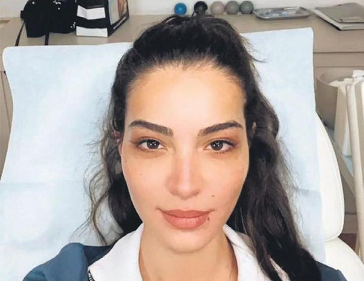 Melisa Aslı Pamuk da estetik operasyon geçirdi