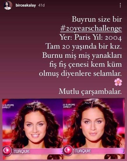 Birce Akalaydan yıllar sonra estetik açıklaması geldi