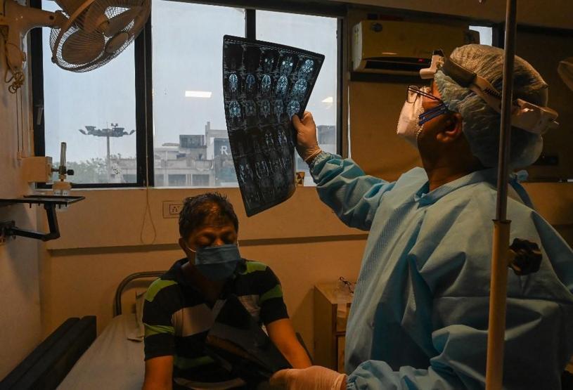 Hindistanda ölümcül kara mantar alarmı: Hastalık nasıl yayılıyor, belirtileri neler