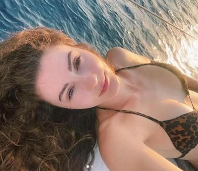 Burcu Özberk estetik iddialarına böyle cevap verdi