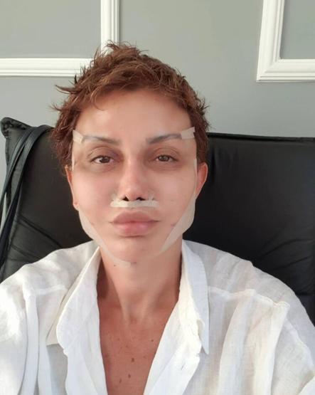 Ünlü sunucu Serap Paköz Benim neyim eksik ki dedi, bıçak altına yattı İşte son hali