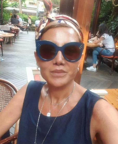 Estetik operasyon geçiren Serap Paközün son hali