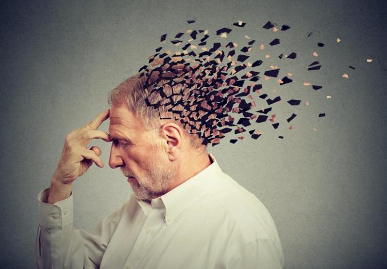 Alzheimer için korkutan uyarı; 2050’de Türkiye 4’üncü sırada