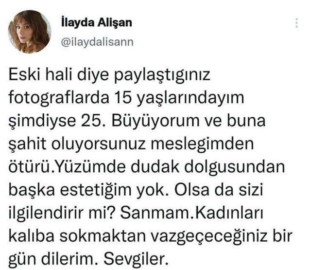 İlayda Alişandan estetik açıklaması
