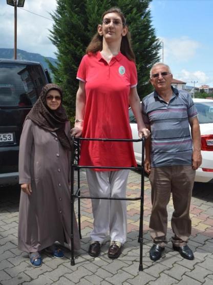 Dünyanın en uzun boylu kadını Rümeysa Gelgi, Guinness Rekorlar Kitabına girdi
