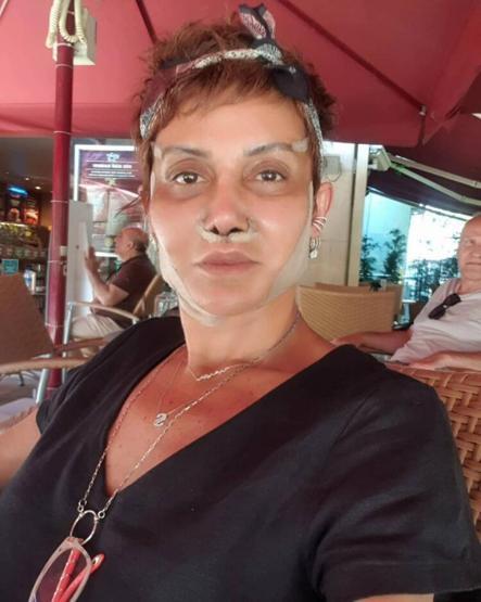 Serap Paköz: Cerrahi bir işlem yaptırmadım