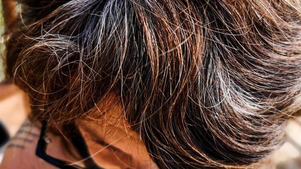 Genç yaşta saçları beyazlatan 6 neden ve bunu önlemenin yolları