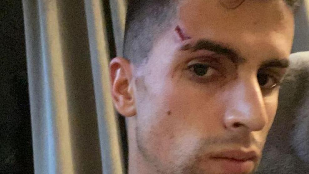Joao Cancelo evine giren hırsızların saldırısına uğradı