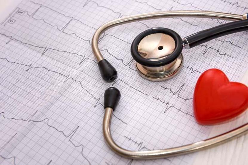 Dikkat Kalp krizinde hayat kurtarıyor Anjiyografi hakkında en çok merak edilen 8 soru