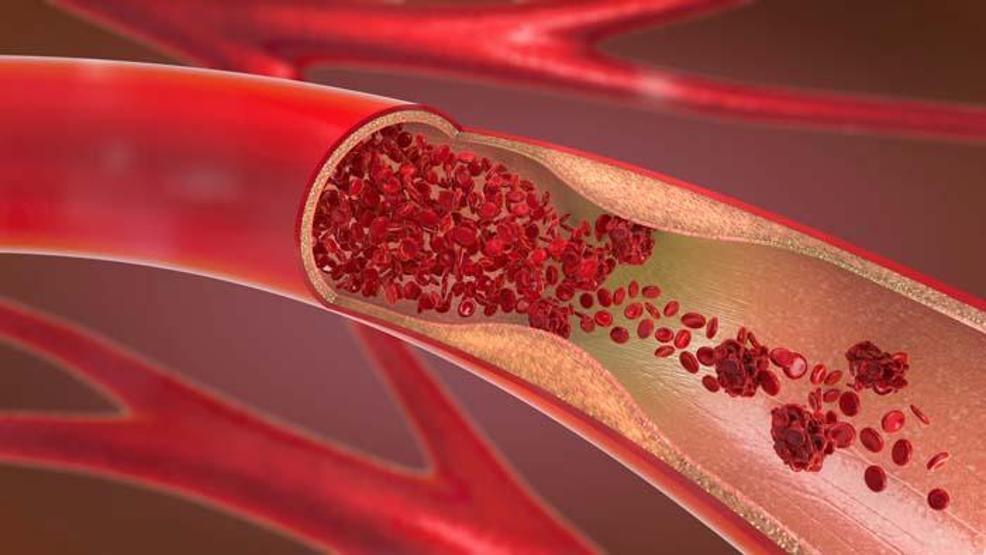 Demir eksikliğinin 20 belirtisine dikkat