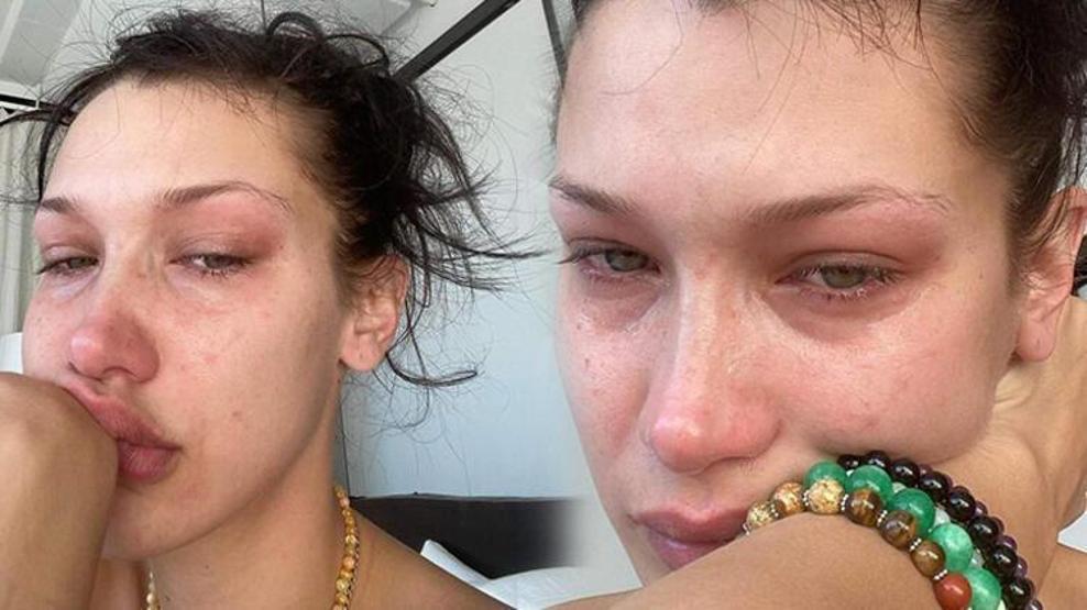 Bella Hadid zihinsel sağlık sorunları olduğunu açıkladı