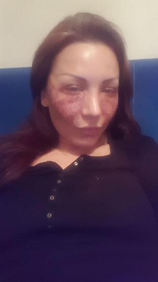 Bulgar modelin estetik kabusu