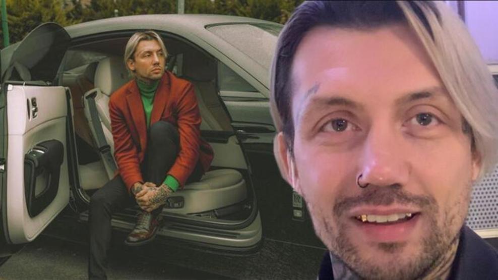 Barış Kenan Özkanın altın dişleri dikkat çekti