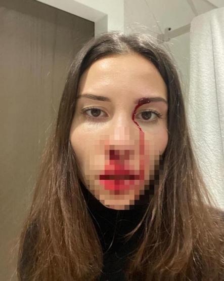 Mihriban Hurmacı yaşadığı ekonomik şiddeti böyle anlattı