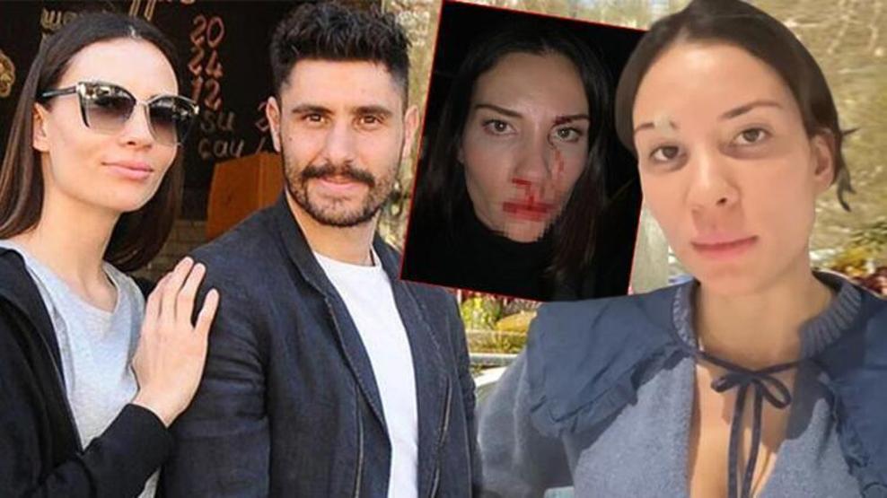 Mihriban Hurmacı yaşadığı ekonomik şiddeti böyle anlattı