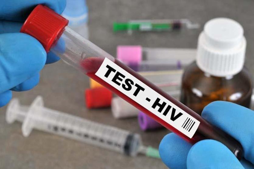 Oxford duyurdu: Yeni HIV varyantı AIDS vakalarını iki katına çıkarabilir