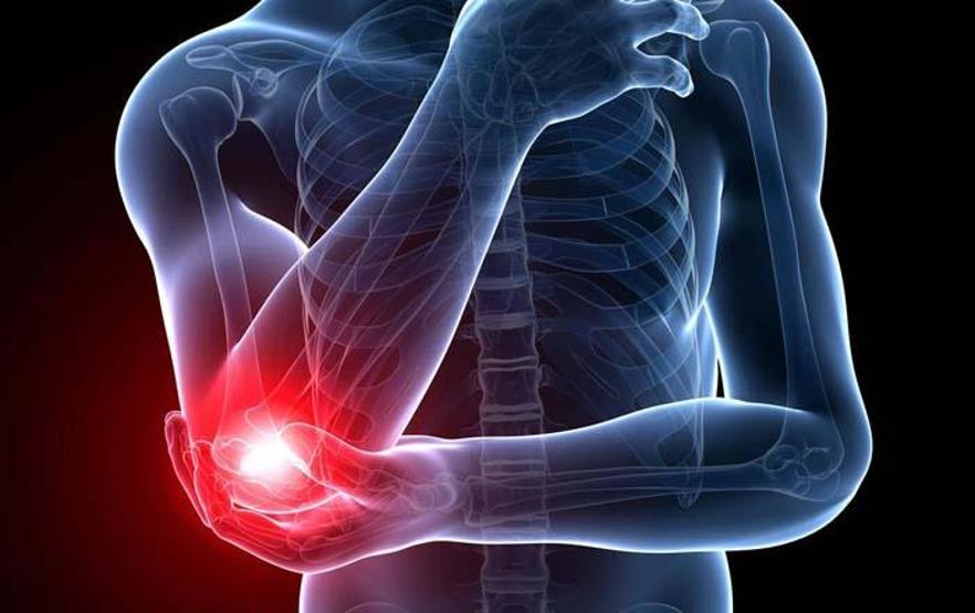 Tenisçi Dirseği nedir Önleme yolları, belirtileri ve tedavi yöntemleri