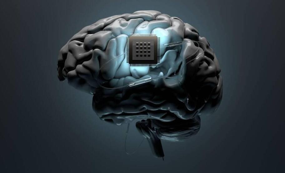 Musk reddetti, üniversite doğruladı… Tartışmalı Neuralink projesinin perde arkasında neler yaşanıyor