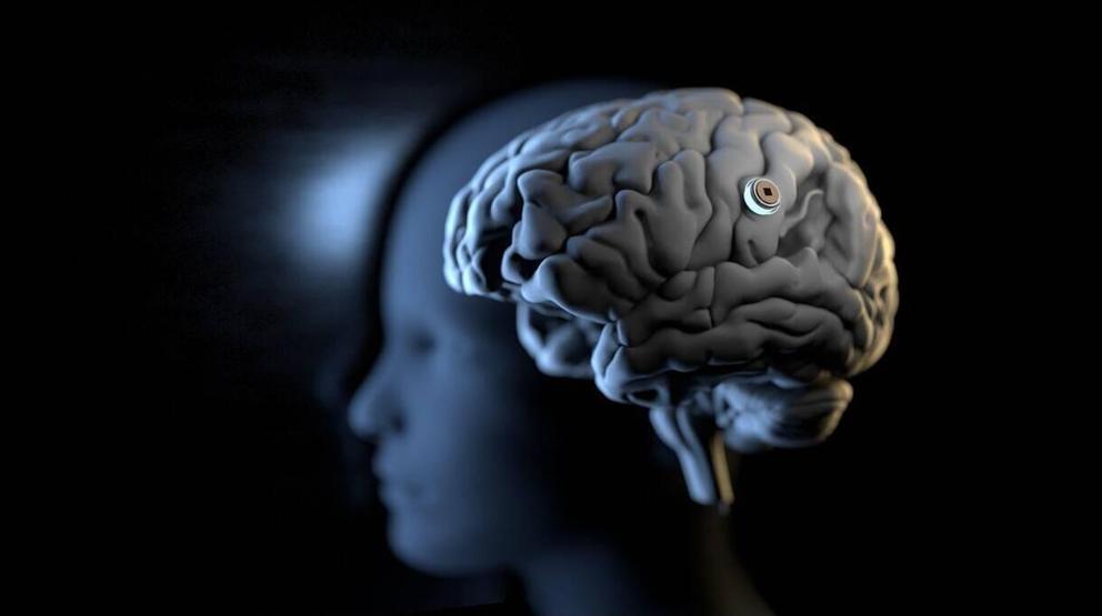 Musk reddetti, üniversite doğruladı… Tartışmalı Neuralink projesinin perde arkasında neler yaşanıyor
