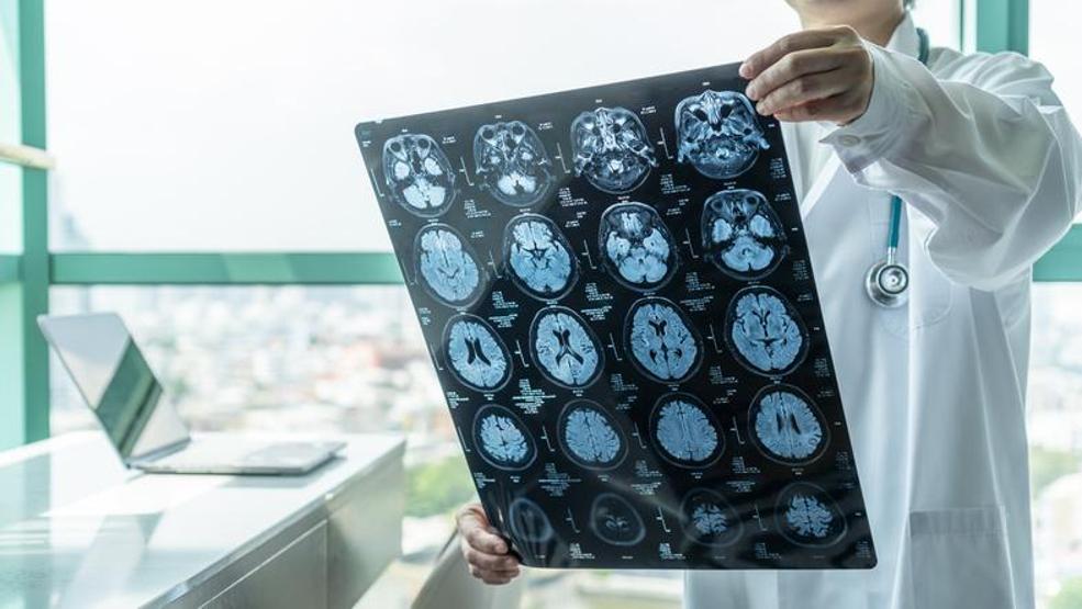 Alzheimer tedavisinde umut ışığı
