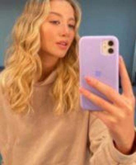 Survivor Aleyna Kalaycıoğlu estetik sorusuna fena kızdı