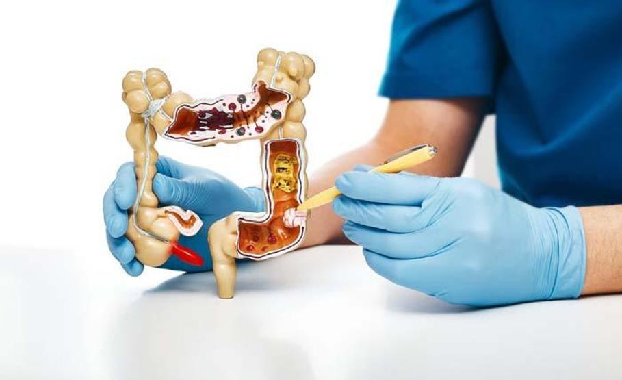 Gastroenteroloji uzmanından önemli çağrı: “Kolonoskopiden korkmayın”