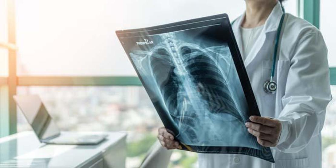 Pandemi sonrası verem artabilir Tüberkülozun en sık görülen 6 belirtisi