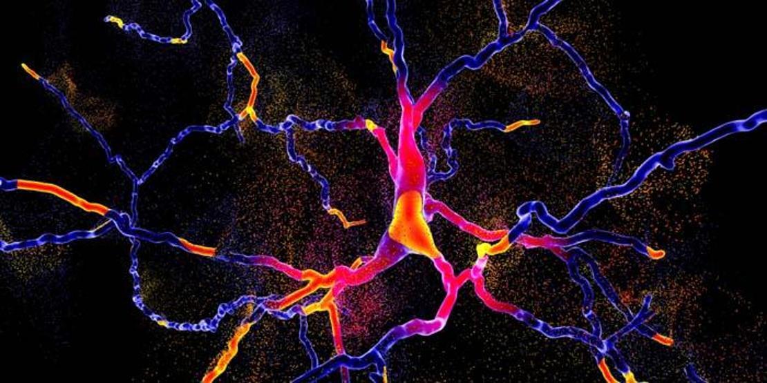 Parkinson hastalığında belirtiler neler