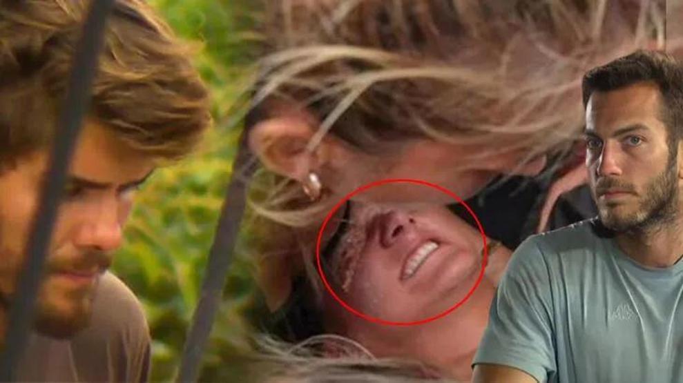 Survivorda ikinci eleme adayı belli oldu Nisanın sakatlığına Barışın gözyaşları damga vurdu