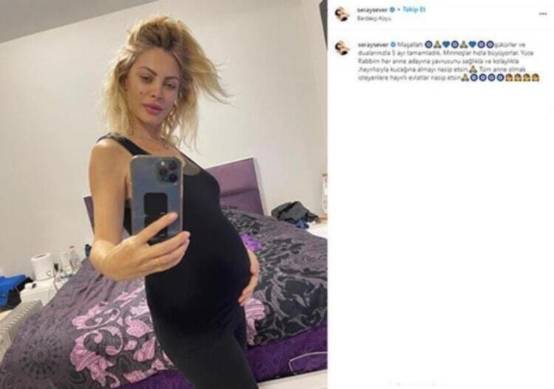 Seray Sever zorlu doğum sürecinde yaşadıklarını anlattı