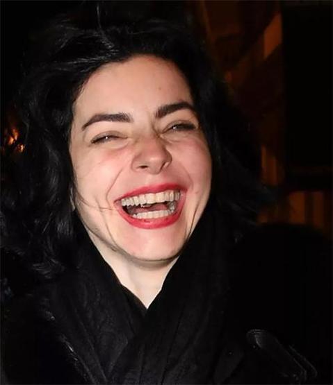Merve Boluğurdan botoks yanıtı: Herkes benzer surat