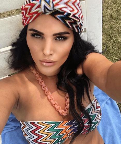 Berdan Mardininin eski eşi Fatoş Yellilerden mini şortlu poz