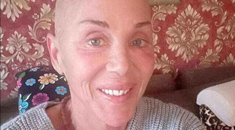 Kansere yakalanan Billur Kalkavanın son sağlık durumu nasıl