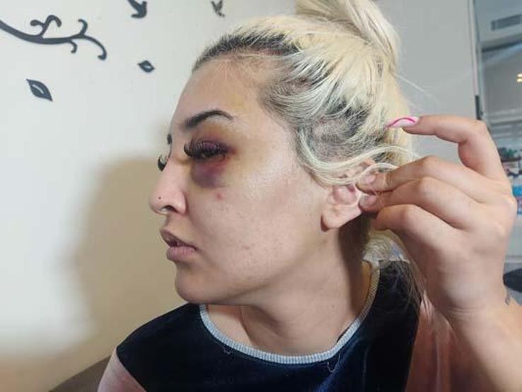 Eski sevgilisinden 3 saat şiddet gören Gamze, şikayetini geri çekti