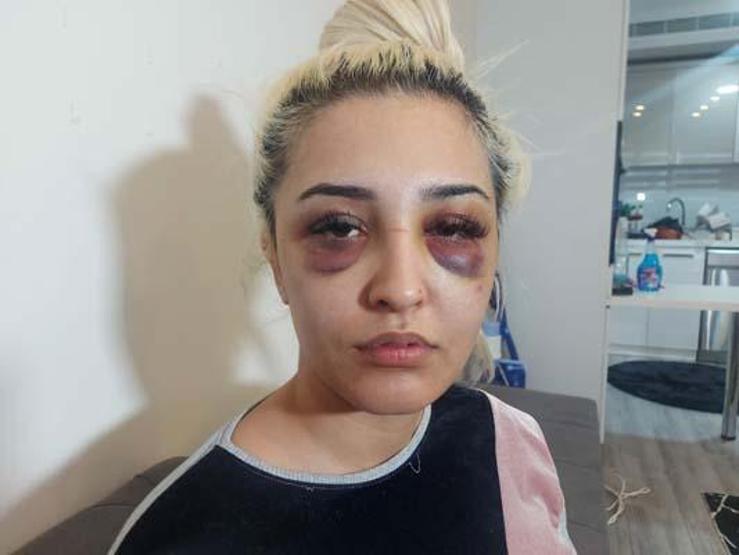 Eski sevgilisinden 3 saat şiddet gören Gamze, şikayetini geri çekti