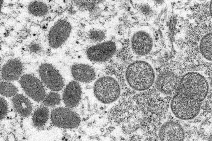 Maymun çiçeği virüsü, beklenmedik bir hızla mutasyona uğradı