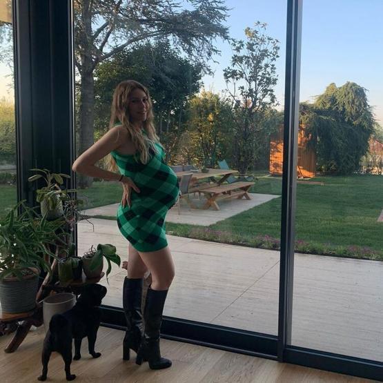 Sinem Kobaldan doğum sonrası ilk fotoğraf geldi