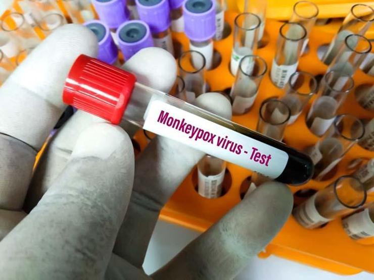 Maymun çiçeği hamilelikte riskli olabilir