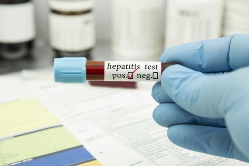 Dünya Hepatit Günü: Hastalıktan nasıl korunmalı