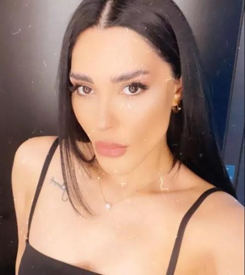 Ayşegül Melisa Doğan estetik sonrası bambaşka biri oldu