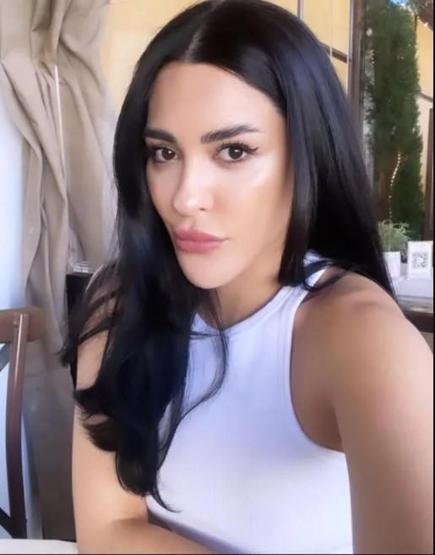Ayşegül Melisa Doğan estetik sonrası bambaşka biri oldu