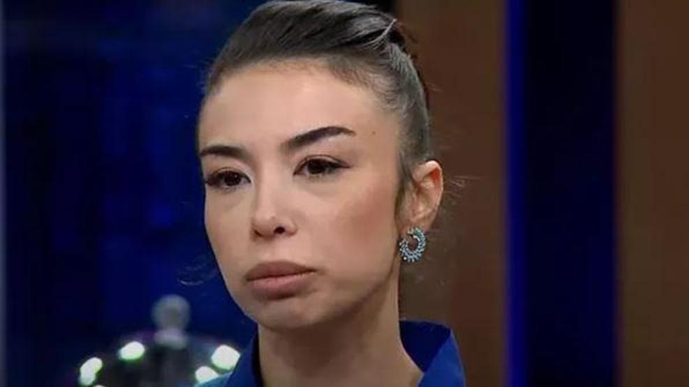 MasterChef Burcu Önalın son hali gündem oldu