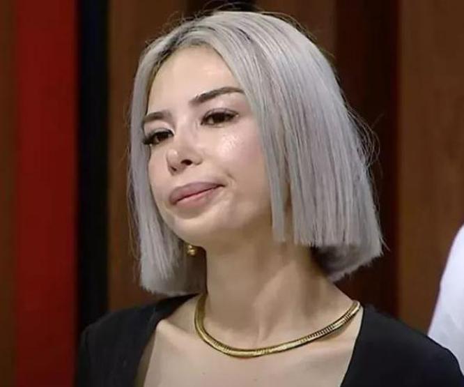 MasterChef Burcu Önalın son hali gündem oldu