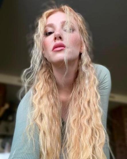 Elçin Sangu ve Yunus Özdiken el ele dişçiye gitti